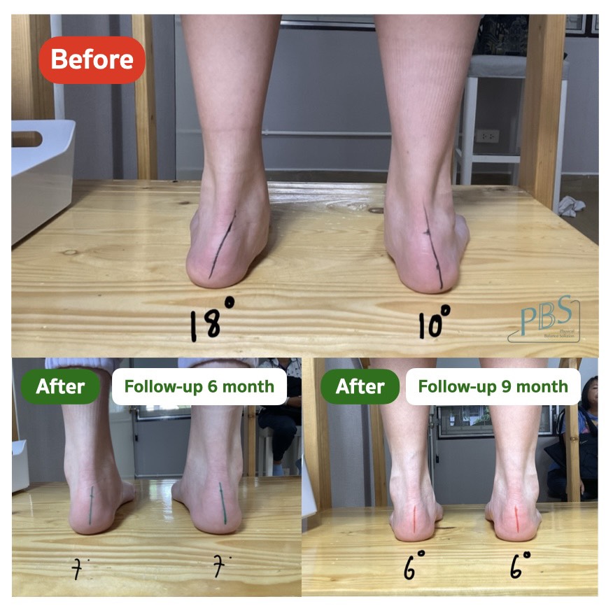 3RjT4acfhfmsDbmfqN8vAuciRsEERhgWHS5EDEVkBCQ-j9gRI9TtQjZw0cAwFKbxU2qjxBHPVdhIOtxw60hHni6U_ZxJtleJgbatKodvJOD6S5JgHmrpCv9lUgopaNpBQ0mGTKiMiK02azDH-NEk1Q==